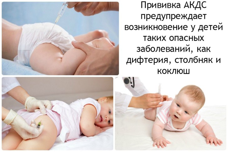 Прививка от столбняка и дифтерии: график вакцинации, побочные эффекты и противопоказания