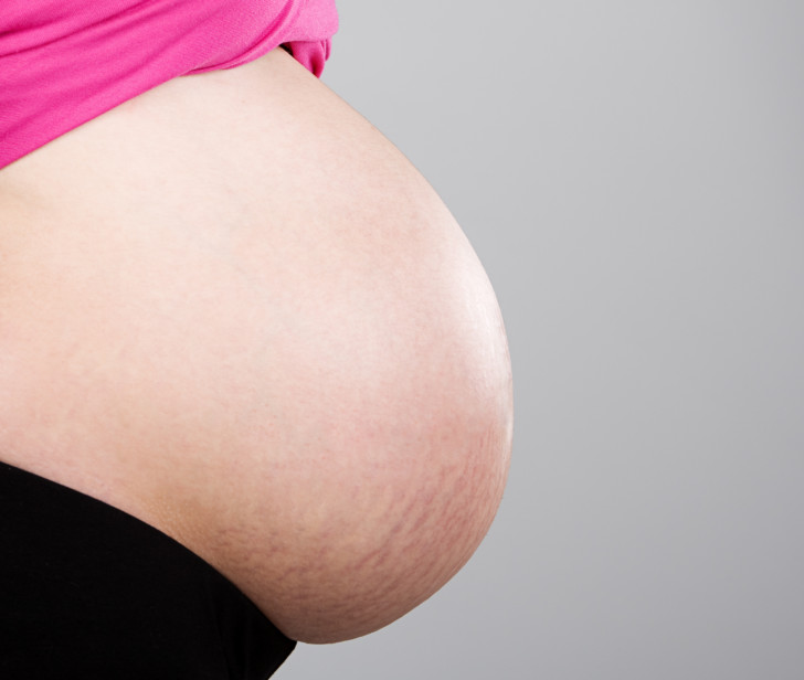 Кремы от растяжек для беременных: обзор самых эффективных косметических средств