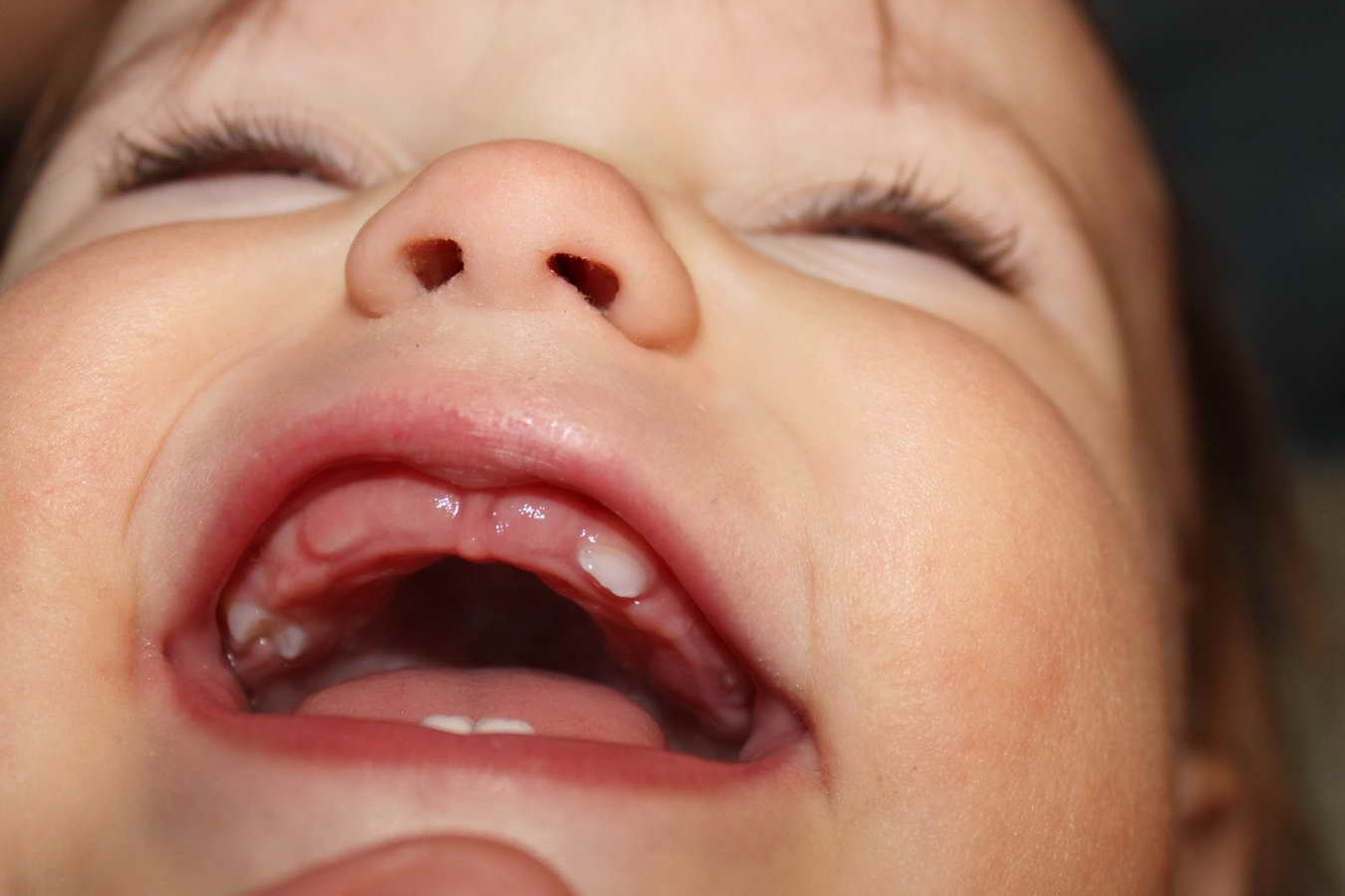 Сроки и порядок прорезывания молочных зубов у грудничков и детей до 3 лет: таблица и график роста