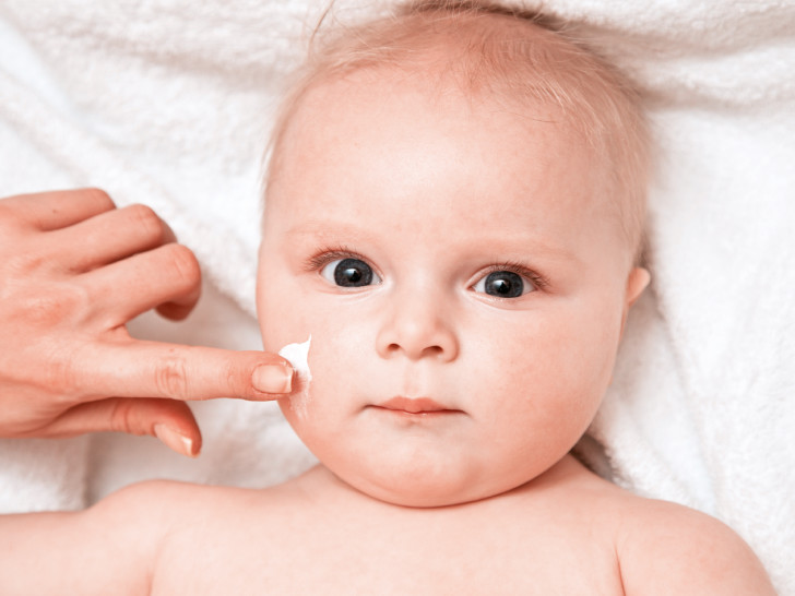 Акридерм: инструкция по применению мази и крема при аллергии у детей