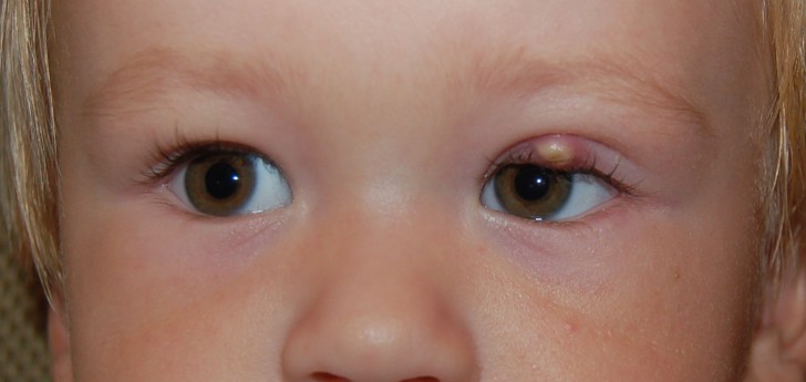 Что делать, если у ребенка покраснели глаза: причины и лечение, сопутствующие симптомы и профилактика