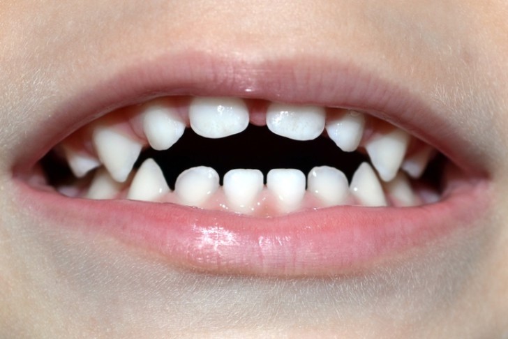 Почему ребенок постоянно держит рот открытым: возможные причины