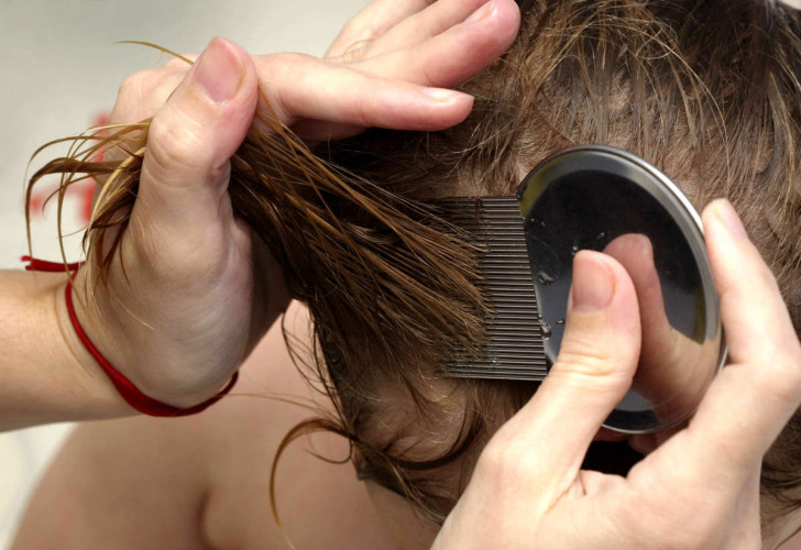 Как вывести вшей в волосах у ребенка: симптомы педикулеза с фото и лечение в домашних условиях