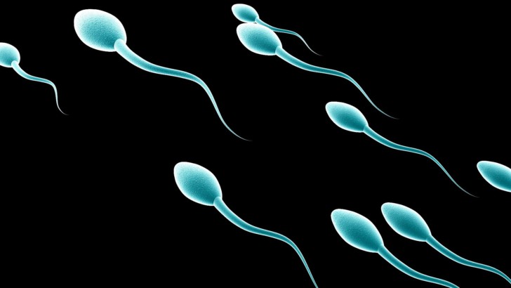 Агрегация и агглютинация сперматозоидов в спермограмме: что это такое и чем чревато?