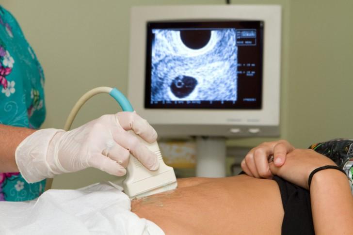 Как часто можно делать процедуру УЗИ в течение беременности и вредно ли это для плода?