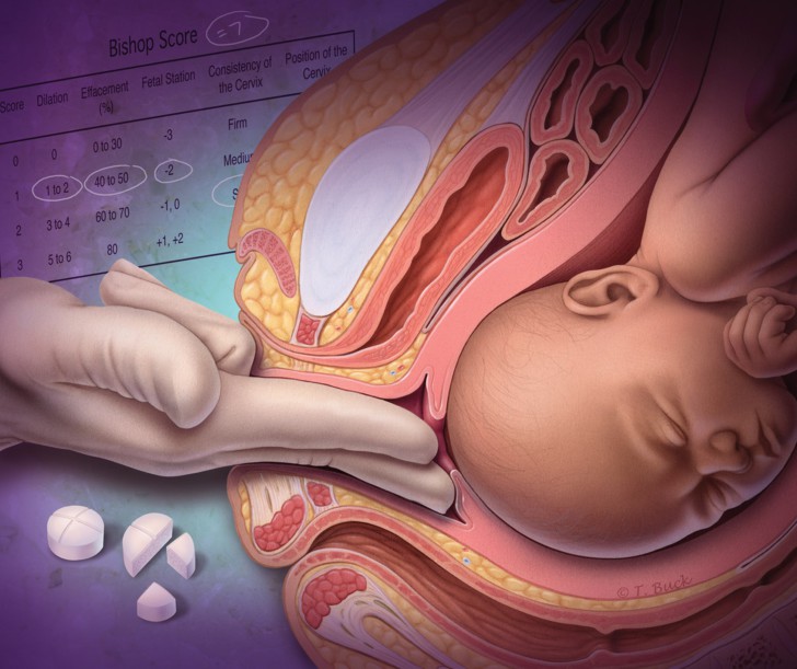 Пальпация шейки матки: как выглядит до зачатия и какие изменения происходят на ранних сроках при беременности?