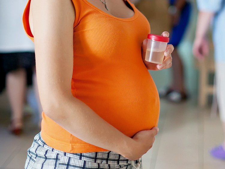 Мутная моча на ранних и поздних сроках при беременности: почему бывает осадок, опасно ли это и что нужно делать?