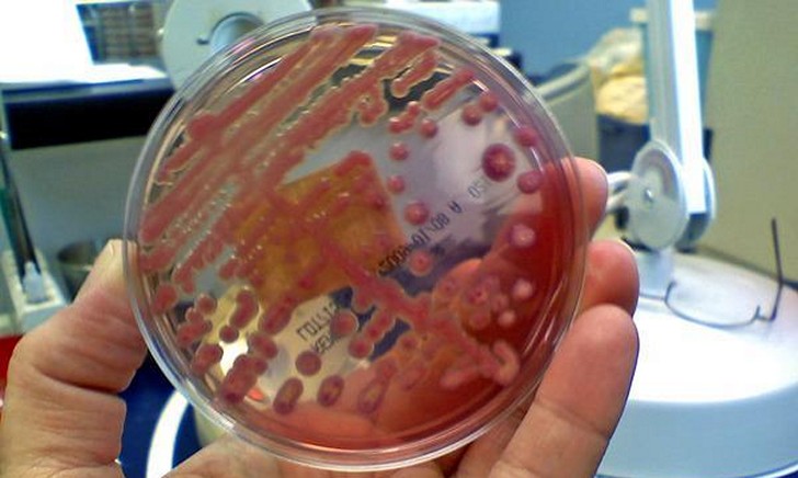 Посев бактерий при диагностировании больного