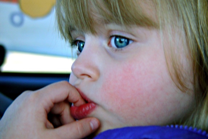 Причины сухости во рту у ребенка, симптомы и способы лечения ксеростомии