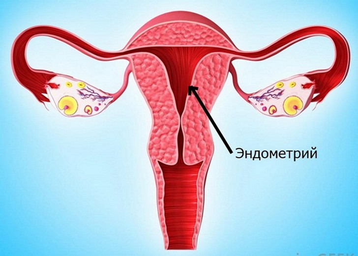 Возможно ли зачатие при тонком эндометрии, каковы нормы его толщины в разные дни цикла и на ранних сроках беременности?