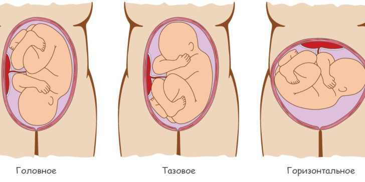На каком сроке беременности ребенок переворачивается вниз головой и принимает окончательное положение в матке?