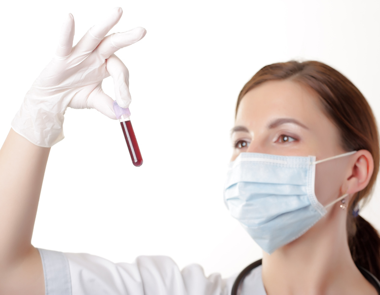 Можно ли сдавать анализ крови во время месячных: как влияет менструация на его результат?