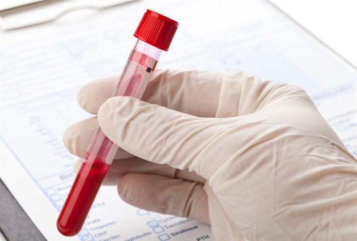 Расшифровка лейкоцитарной формулы крови у детей и норма содержания клеток в таблице