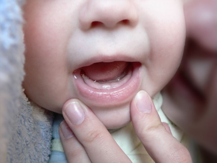 Прорезывание молочных зубов у детей: симптомы у малышей, порядок и очередность появления со схемой