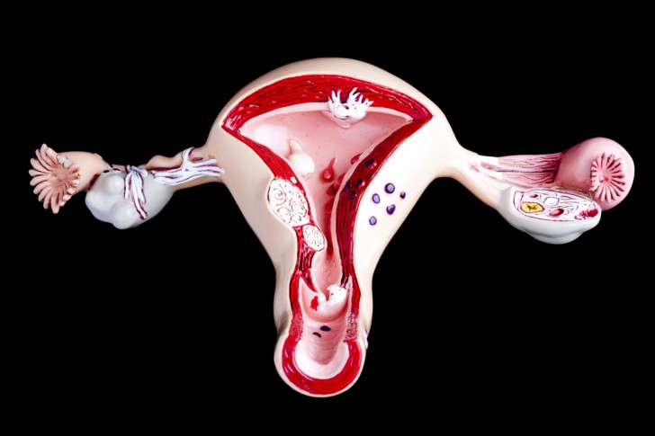 Почему перед месячными болят яичники, может ли это означать беременность?