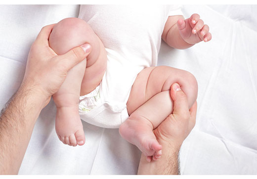 диагностика плоскостопия у новорожденного