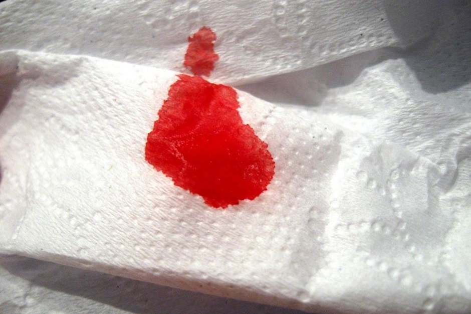 Какого цвета в норме должны быть месячные у здоровой женщины, почему во время менструации идет кровь?
