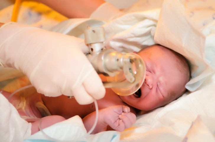 Что такое асфиксия новорожденного: последствия для ребенка, лечение и профилактика