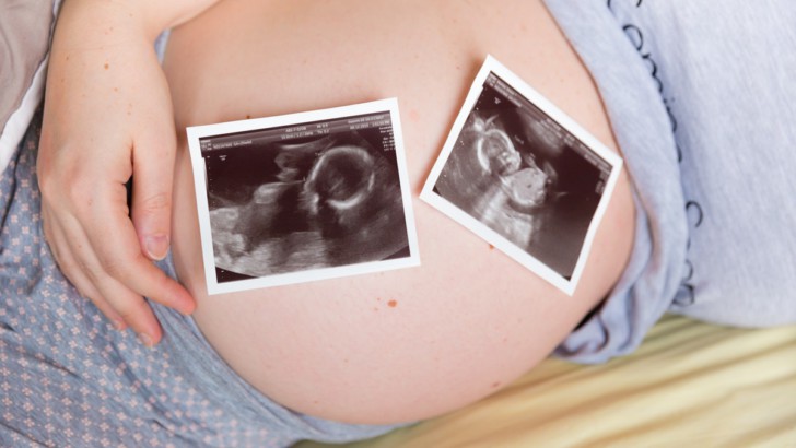 Признаки беременности тройней и двойней на ранних сроках, развитие плодов по неделям, ощущения женщины