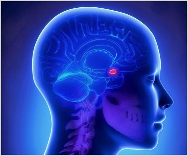 Микроаденома гипофиза головного мозга: лечение, прогноз