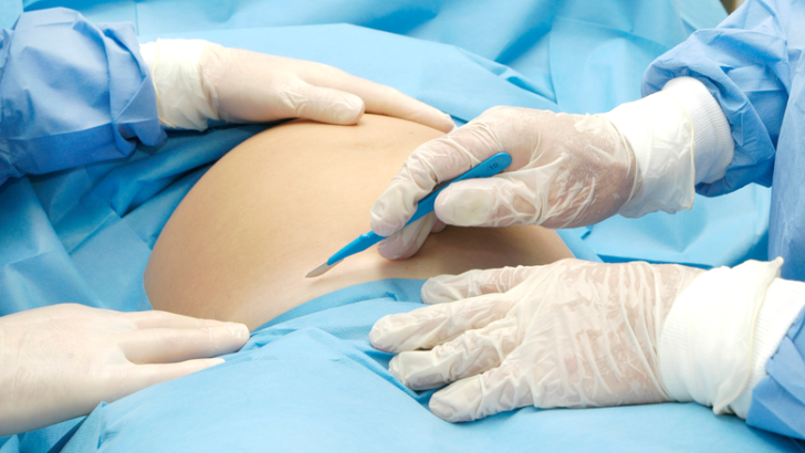 Сколько длится у женщин кесарево сечение по времени при спинальной, эпидуральной анестезии и общем наркозе?