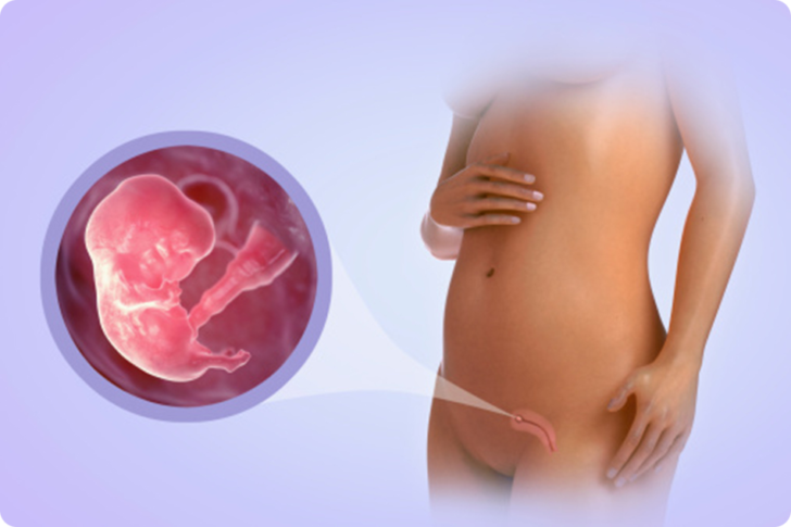 Внематочная беременность на раннем сроке: как определить, что покажет тест?