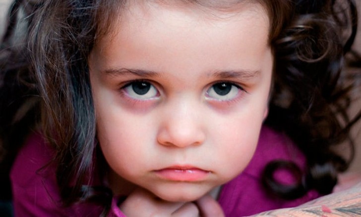 Если у ребенка болезненный вид и темные круги под глазами, необходимо обязательно проконсультироваться со специалистом и выявиться истинную причину симптомов 