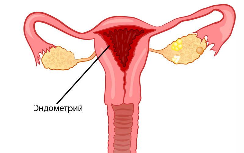 Как быстро нарастить эндометрий для зачатия при планировании беременности?