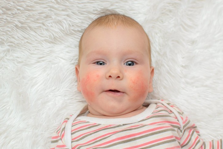 Список лучших капель от аллергии для новорожденных и детей старше 1 года: обзор антигистаминных средств