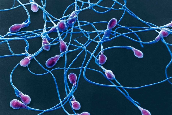 Агрегация и агглютинация сперматозоидов в спермограмме: что это такое и чем чревато?