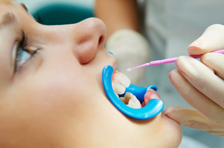 Лечение и профилактика кариеса молочных и постоянных зубов у детей в раннем возрасте