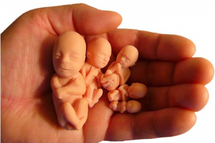 До какого срока делают вакуумный аборт, как он проходит, каковы последствия прерывания беременности?