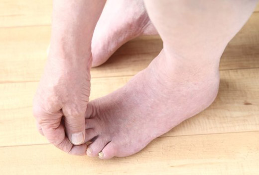 отмирание тканей на пальцах ноги