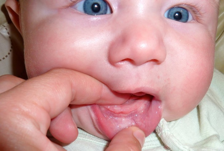 Почему у грудничка или ребенка старше года пахнет ацетоном изо рта: причины и способы лечения