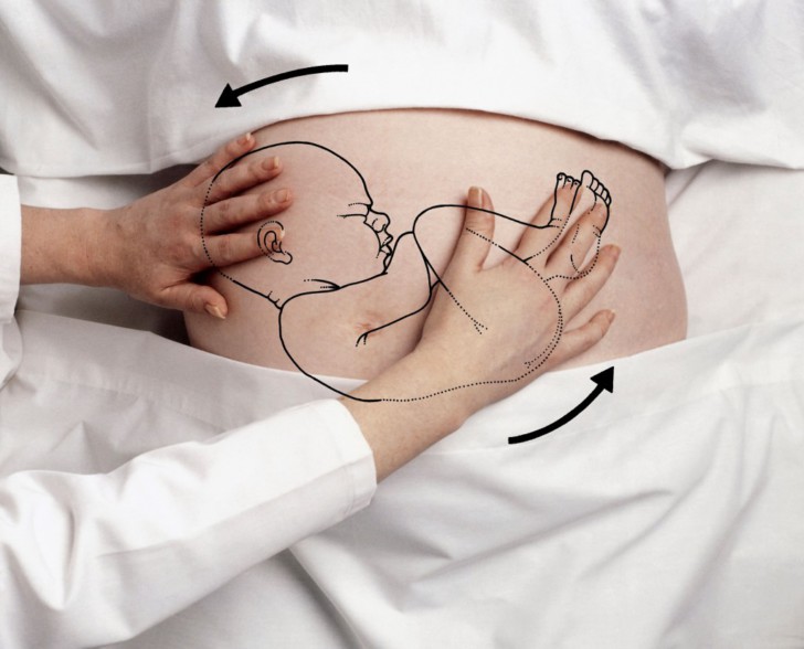 Головное и тазовое предлежание плода при беременности: что это такое и какое положение ребенка соответствует норме?