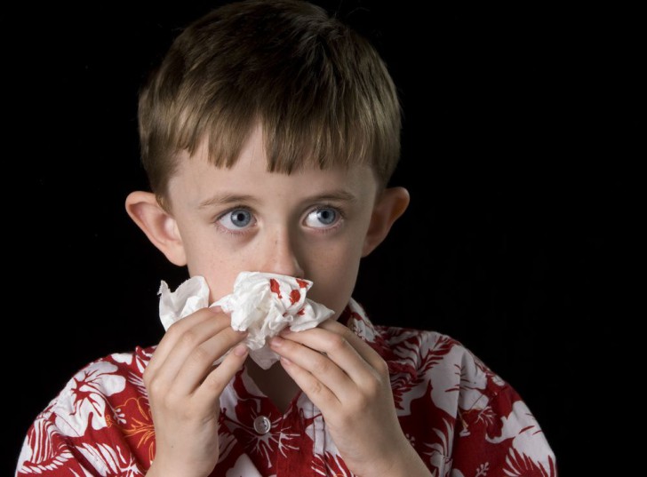 Что делать при ушибе носа у ребенка: симптомы травмы, первая помощь и лечение