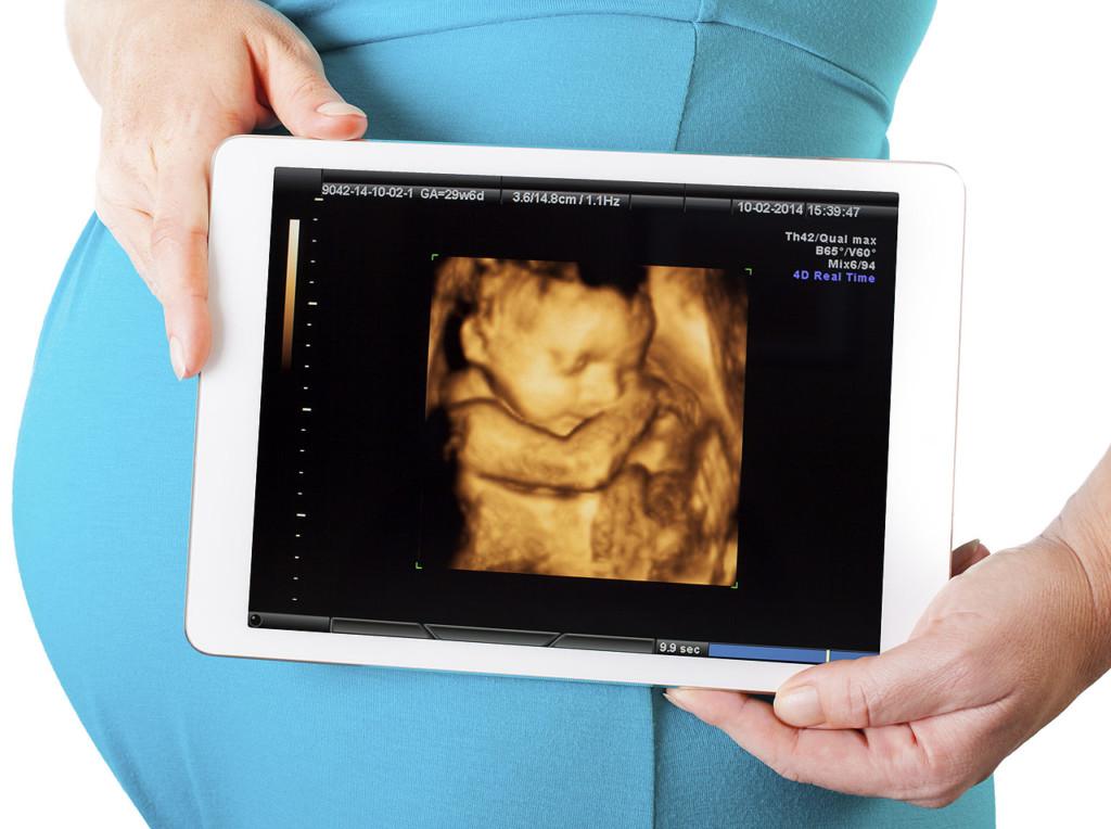 4Д УЗИ плода при беременности: фото и видео процедуры на сроке 20 и 30 недель, отличие от 3д и 5Д