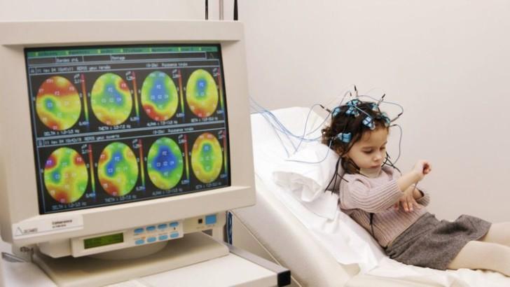 Виды фокальной эпилепсии у детей, характерные симптомы и способы лечения