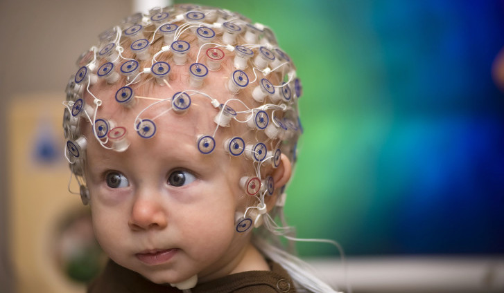 Что показывает ЭЭГ головного мозга у ребенка: нормы, расшифровка результатов и нарушения на энцефалограмме