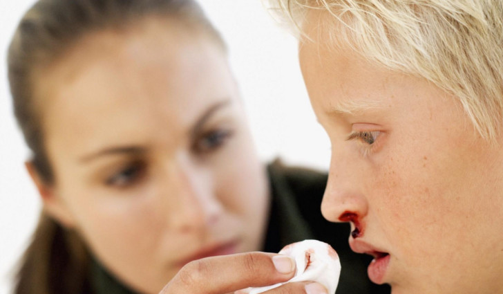 При носовом кровотечении ребенку следует дышать ртом 