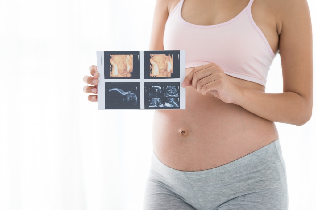 4Д УЗИ плода при беременности: фото и видео процедуры на сроке 20 и 30 недель, отличие от 3д и 5Д