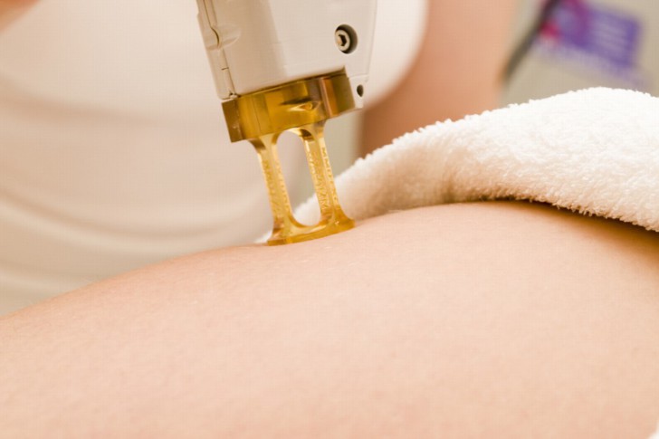 Лазерная эпиляция и беременность: можно ли делать процедуру на ранних сроках?