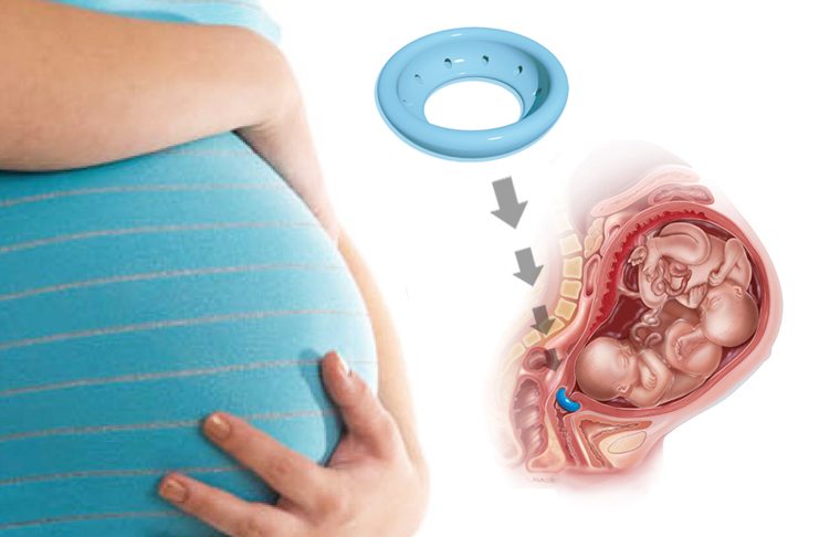 Состояние внутреннего и наружного зева матки при беременности: что означает их раскрытие или закрытие?