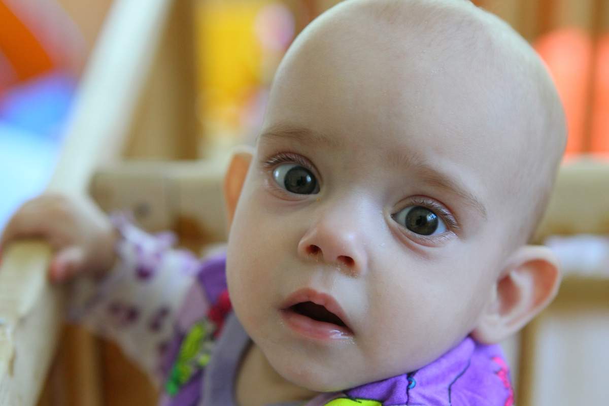 Почему под глазами у ребенка появляются мешки и отеки: причины и лечение припухлости