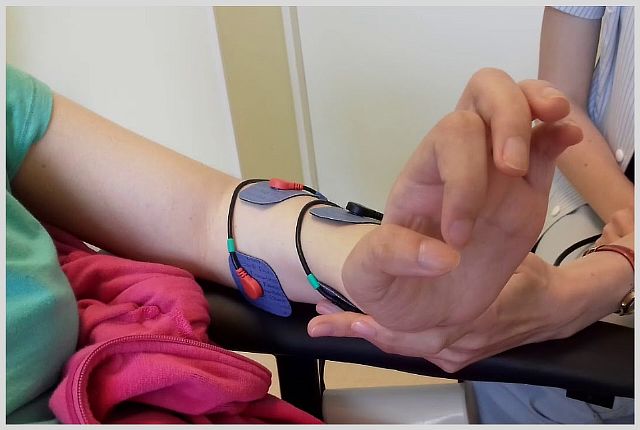 Как восстановить руку после инсульта