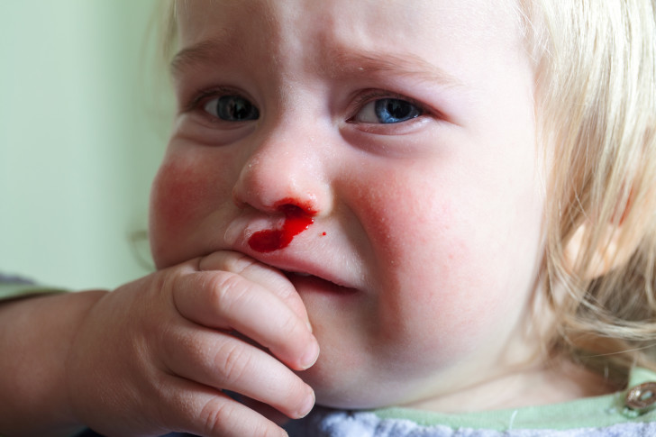 Почему у ребенка пониженный уровень тромбоцитов в крови, о чем это говорит: причины и последствия