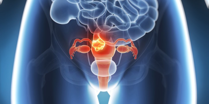 Дозировка Дюфастона при эндометриозе: как правильно принимать при планировании беременности и есть ли противопоказания?